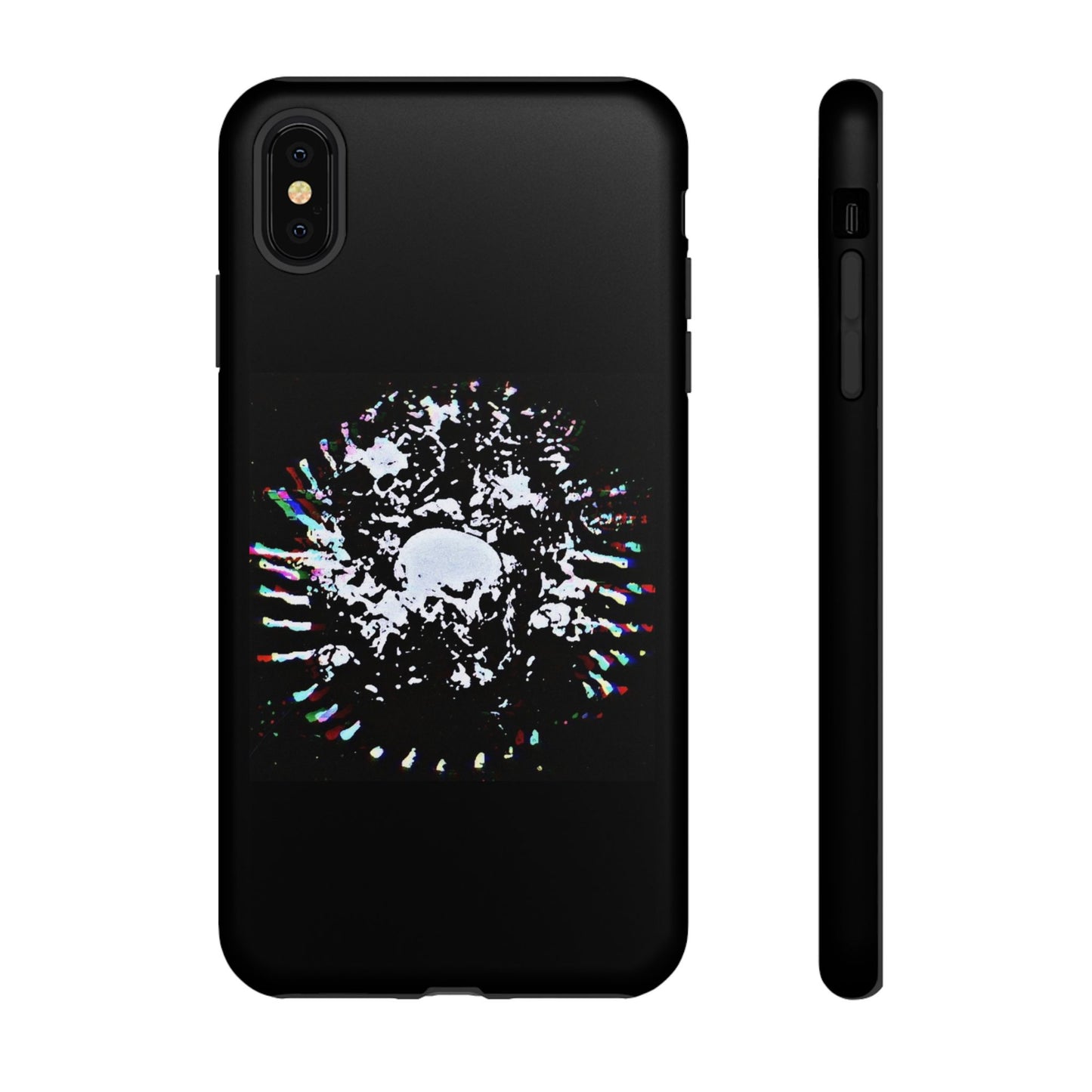 The Døwnerz "Skhelletøn" Phone Cases