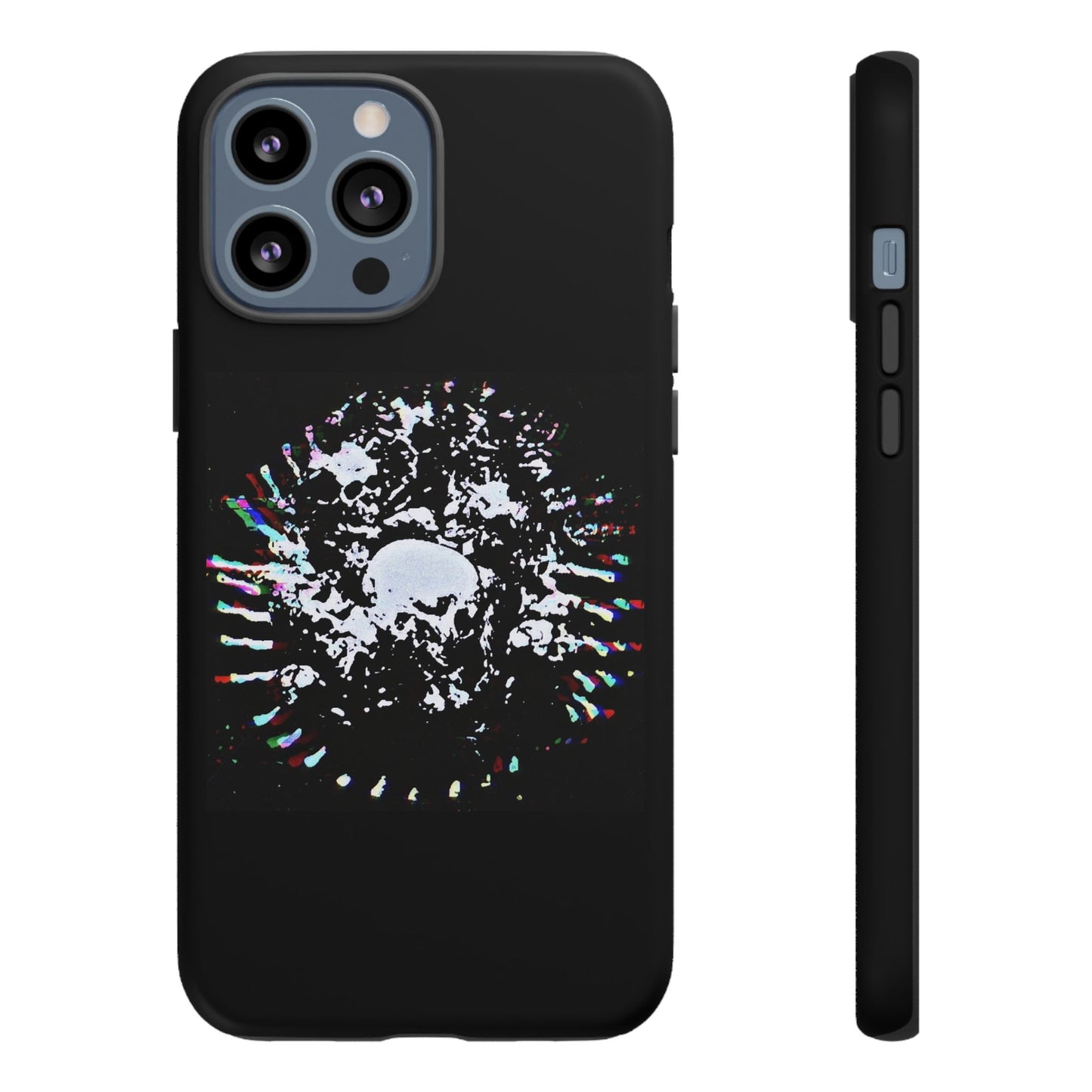 The Døwnerz "Skhelletøn" Phone Cases