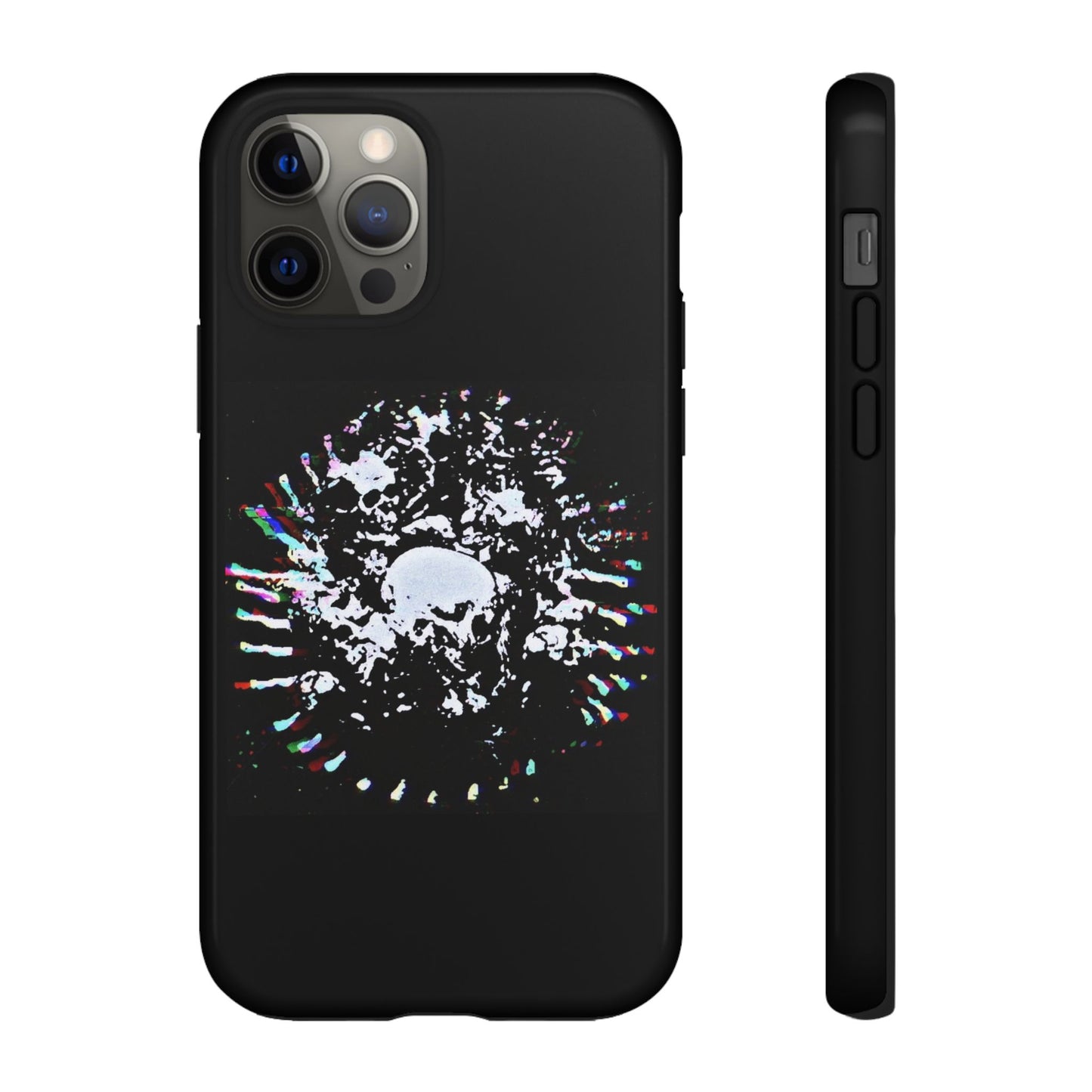 The Døwnerz "Skhelletøn" Phone Cases