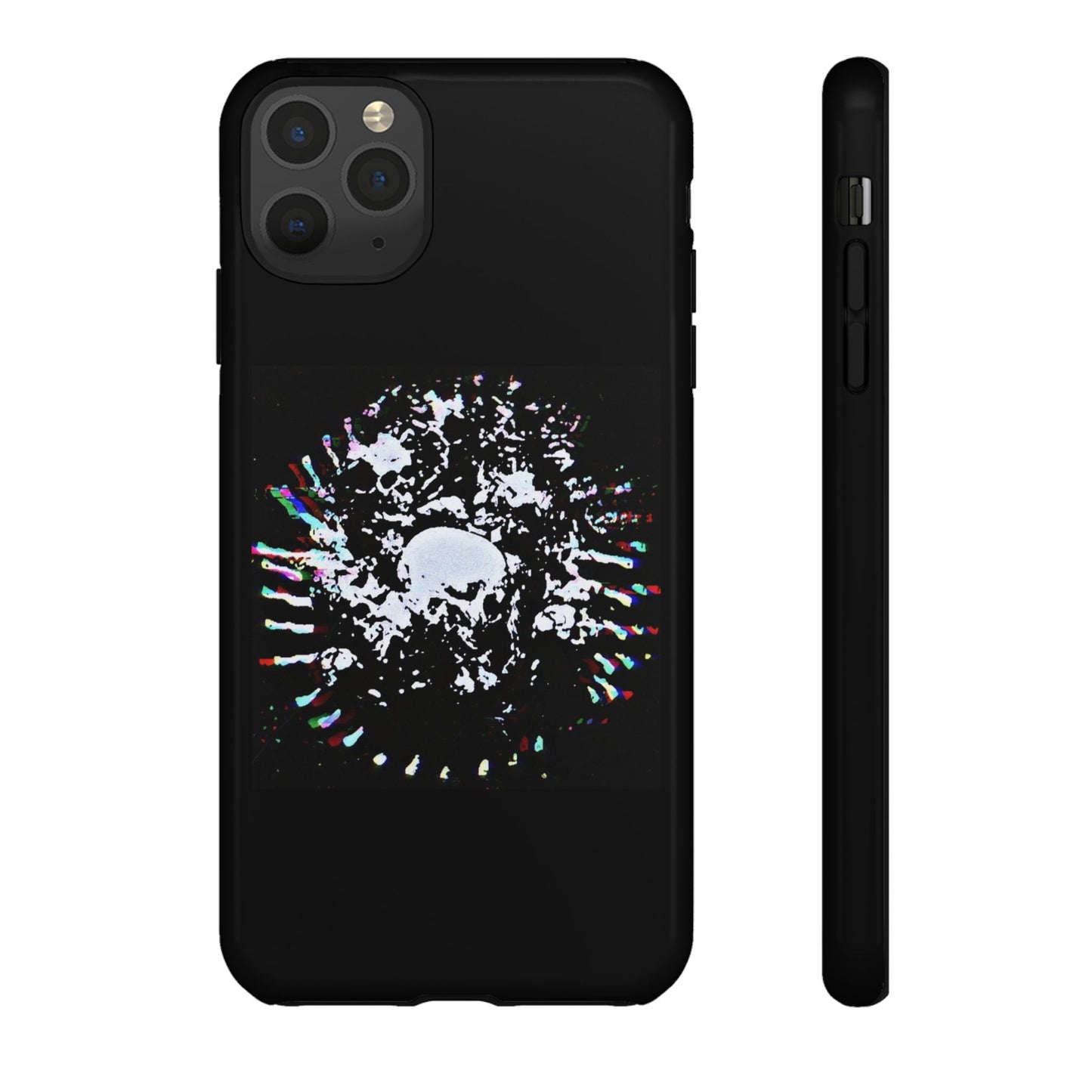 The Døwnerz "Skhelletøn" Phone Cases