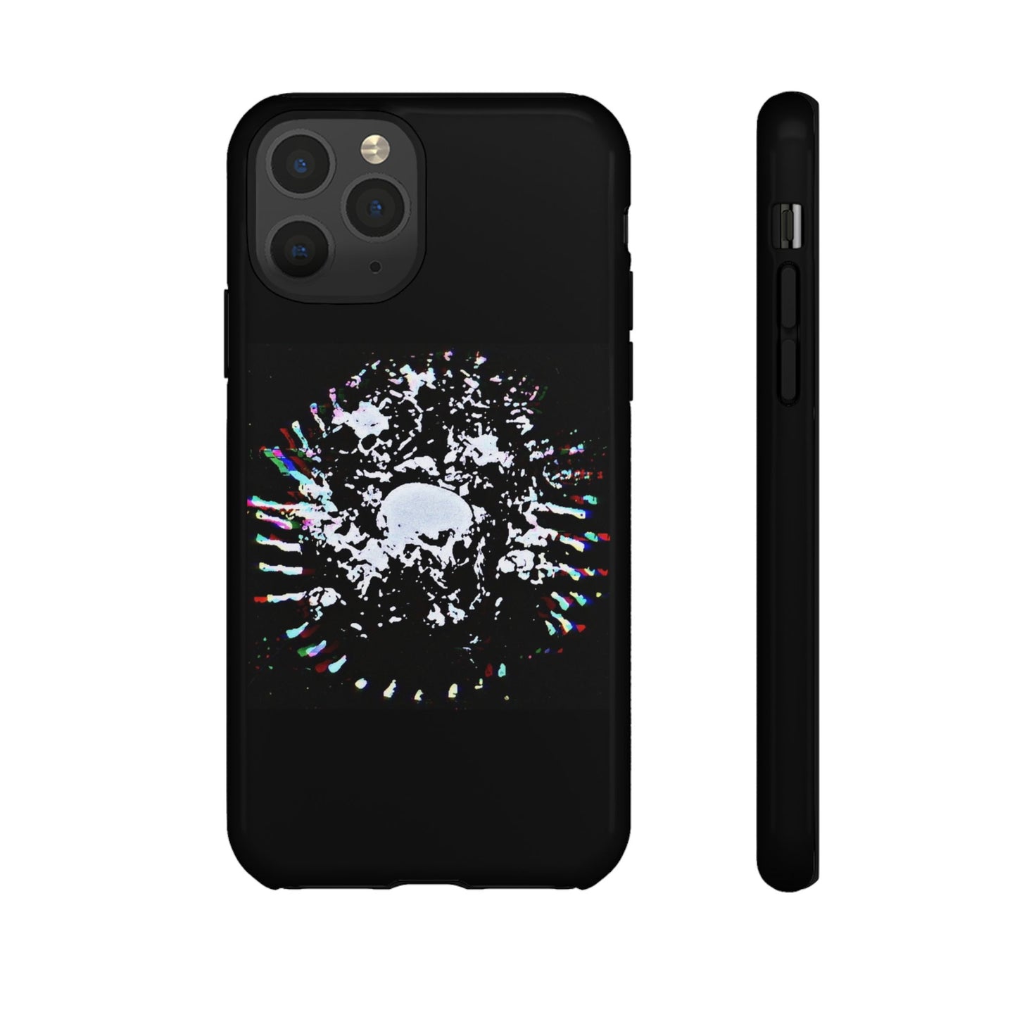 The Døwnerz "Skhelletøn" Phone Cases
