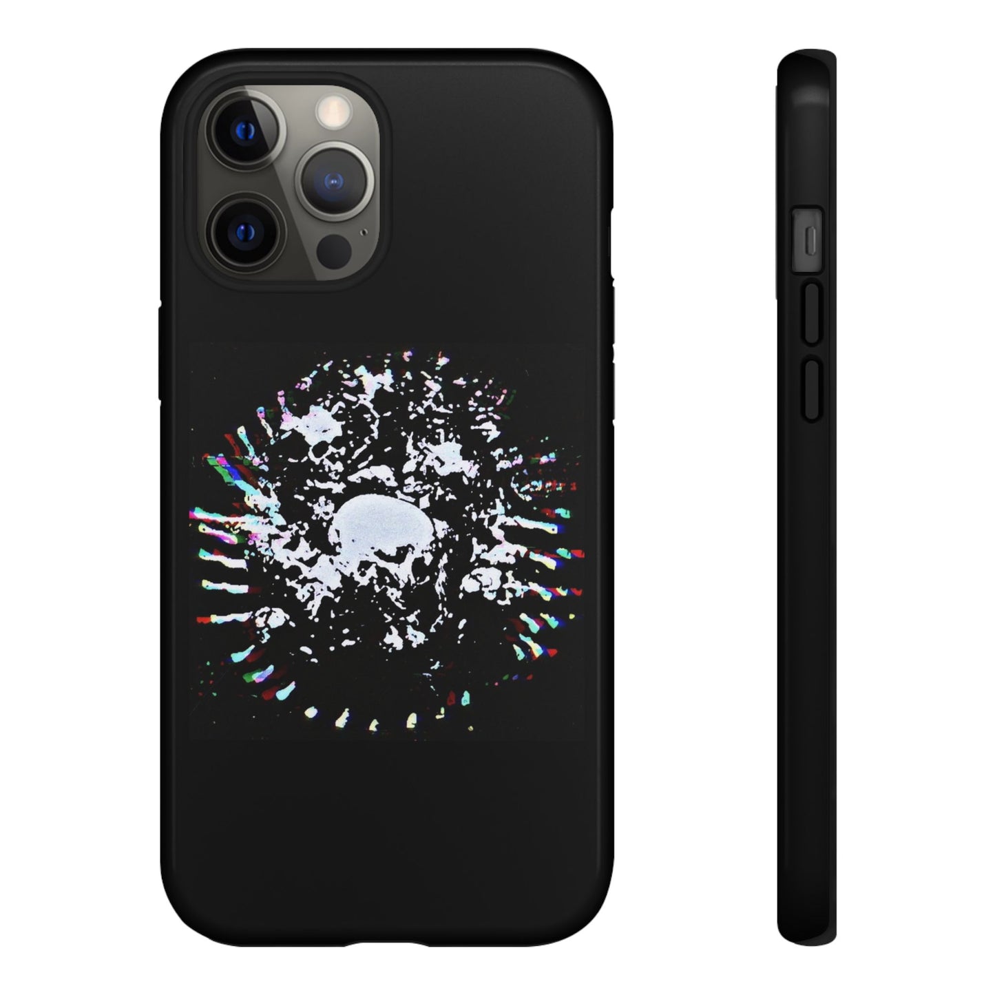 The Døwnerz "Skhelletøn" Phone Cases