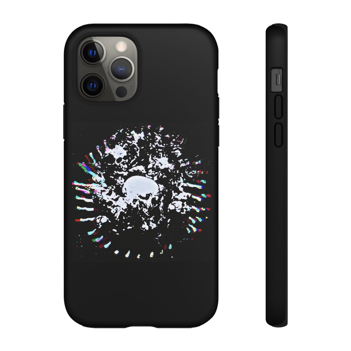 The Døwnerz "Skhelletøn" Phone Cases