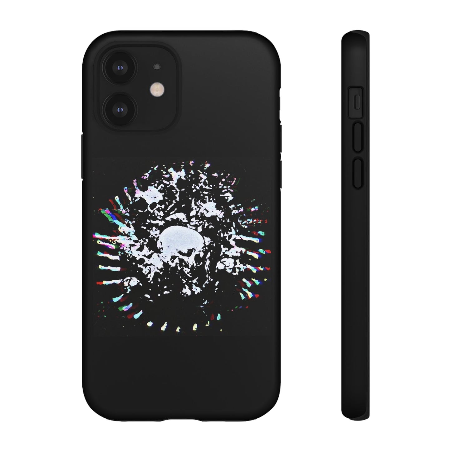 The Døwnerz "Skhelletøn" Phone Cases