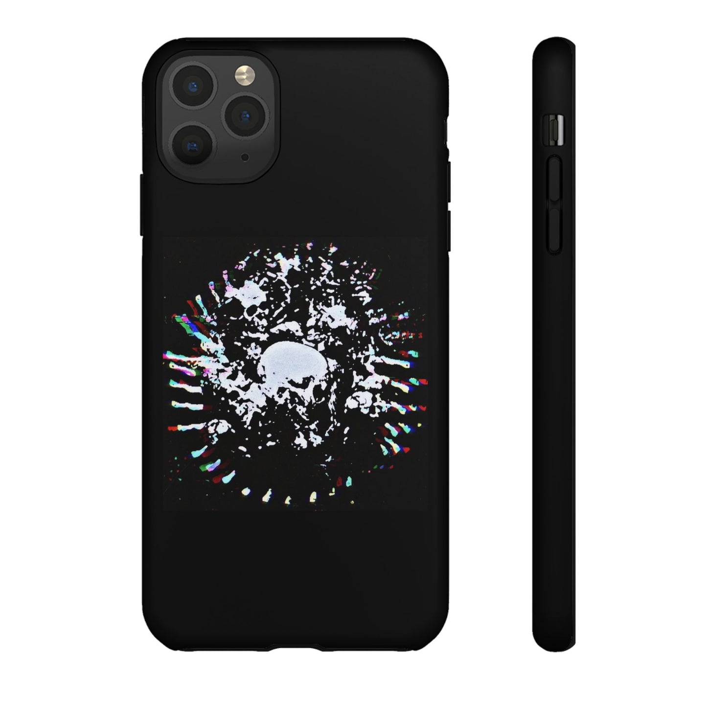 The Døwnerz "Skhelletøn" Phone Cases